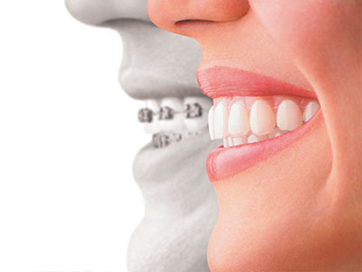 Image  A digital composite featuring a smiling woman on the left and a man s teeth with an exaggerated smile on the right, with a ghostly outline of a face in between.